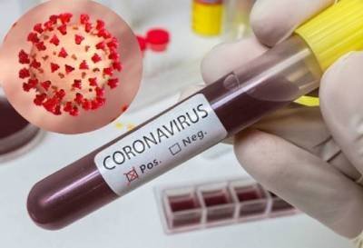 Armenia reports 168 new cases of coronavirus - The US Armenians
